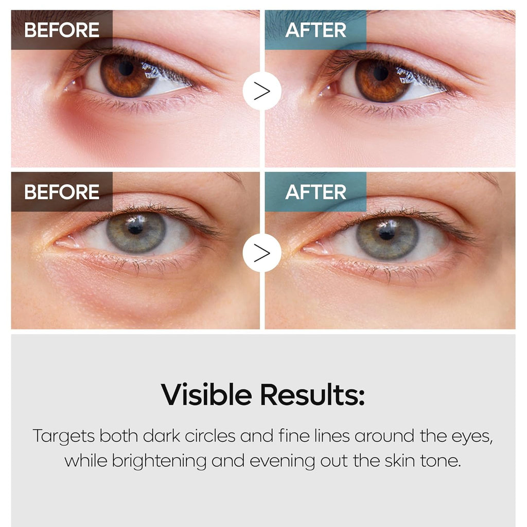Dr. Melaxin TX Retinalsome Double Effect Eye Cream
