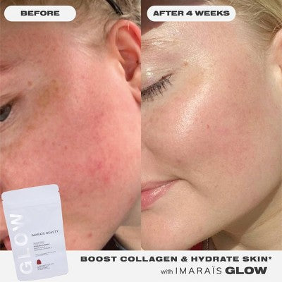 Imarais Beauty Glow Skincare Gummies Vegan and Sugar-Free 30ct - Imperfect Container