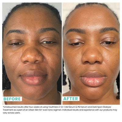 Urban Skin Rx Youth Hero 2-in-1 AM Serum & PM Serum - Imperfect Box
