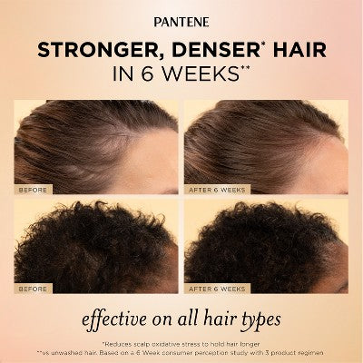 Pantene Abundant & Strong Treatment Serum 2 fl oz - Imperfect Box