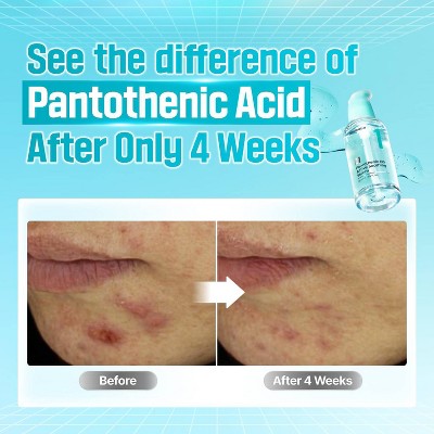 numbuzin No.1 Pantothenic B5 Active Soothing Serum 1.69 fl oz - Imperfect Box