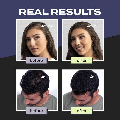 Toppik Hair Building Fibers Medium Brown 0.42 oz - Imperfect Container