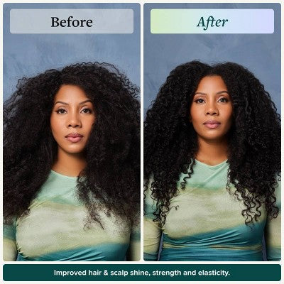 Alodia Nourish and Grow Healthy Hair and Scalp Oil 8.5 fl oz - New