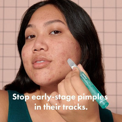 Hero Pimple Correct Pen 0.34 fl oz EXP 05/2026 - Imperfect Box