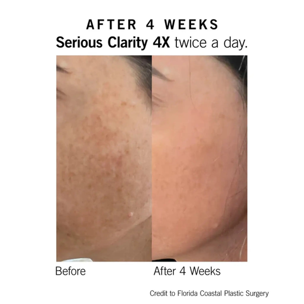 Neova Serious Clarity 4X 1 Oz