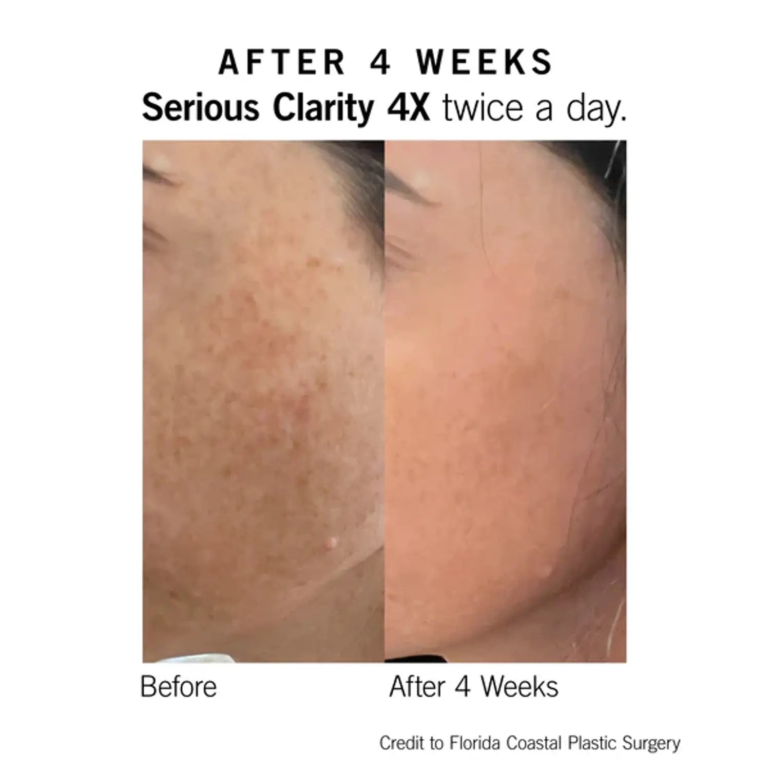 Neova Serious Clarity 4X 1 Oz