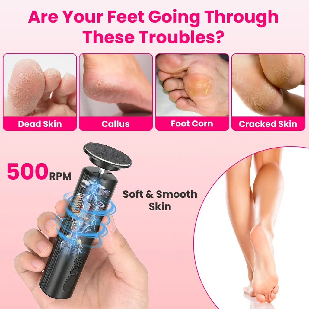 Electric Foot Callus Remover and Nail Grinder Kit