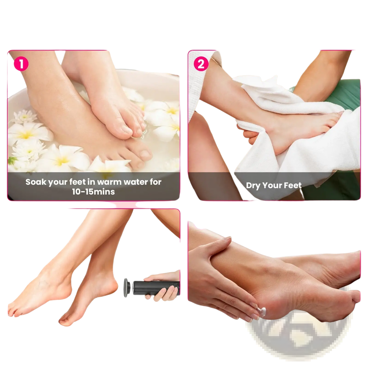 Electric Foot Callus Remover and Nail Grinder Kit