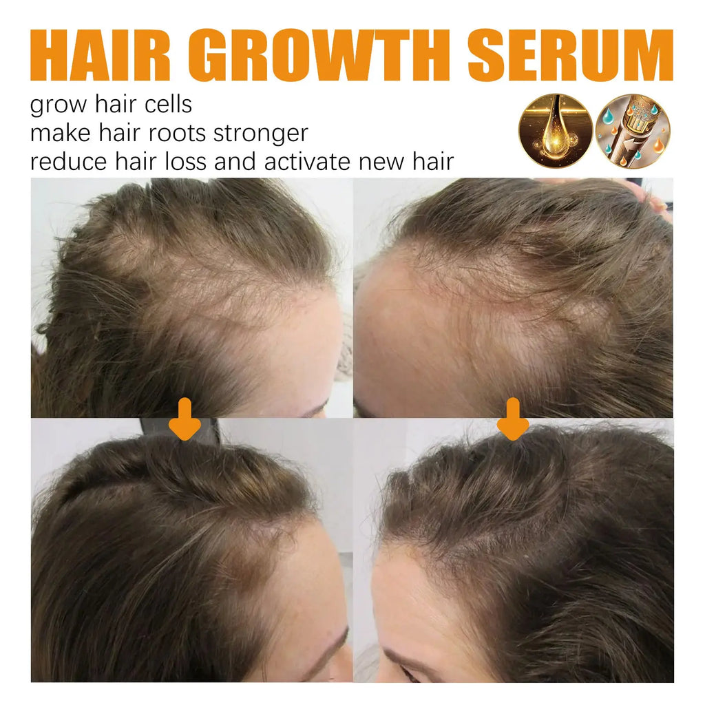 Hair Growth Serum Anti Hair Fall Oil 30ml
