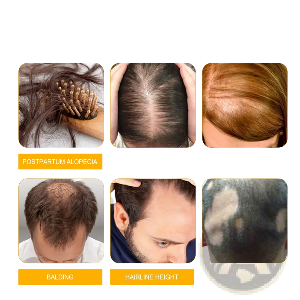 Hair Growth Serum Anti Hair Fall Oil 30ml