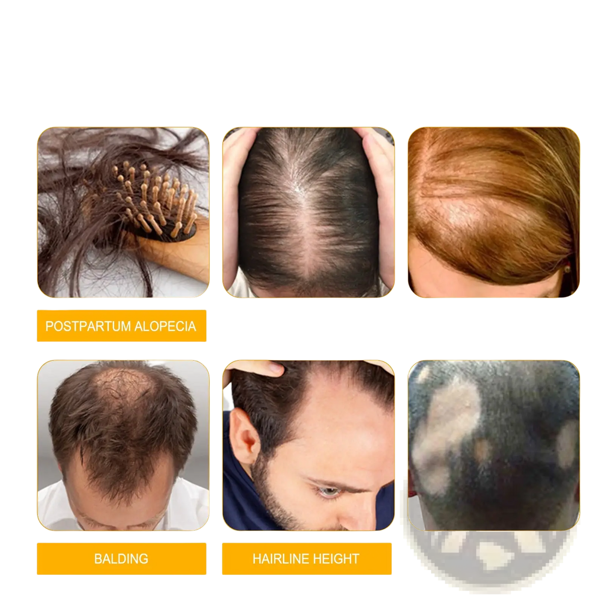 Hair Growth Serum Anti Hair Fall Oil 30ml