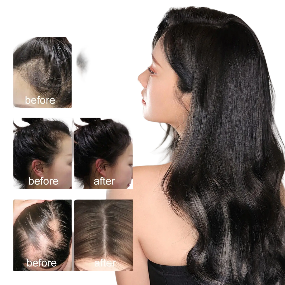 Hair Growth Serum Anti Hair Fall Oil 30ml
