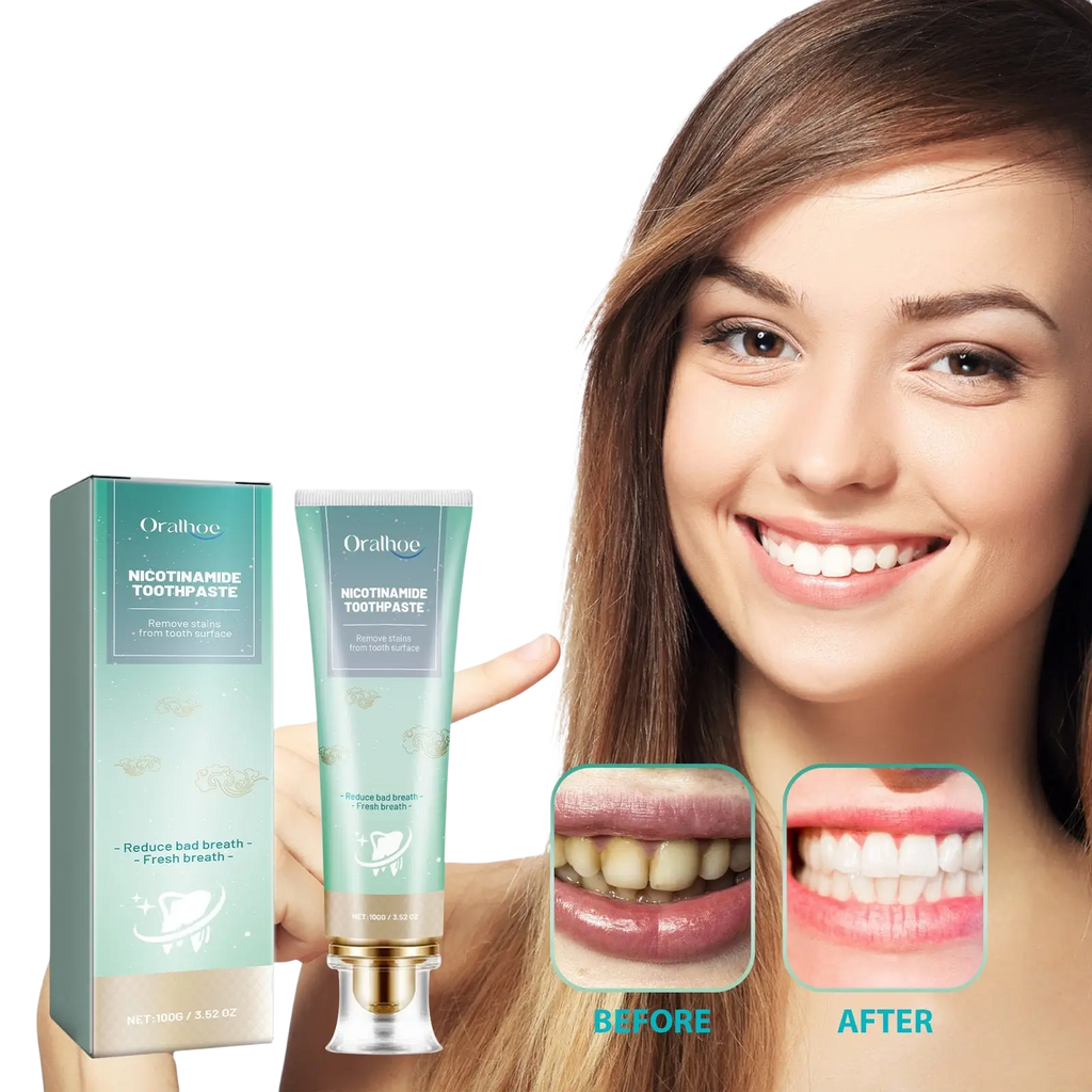 Nicotinamide Teeth Whitening Toothpaste Stain Removal 100g