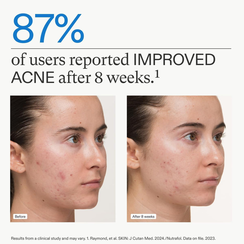 Nutrafol Clear Skin Nutraceutical Acne Supplement 3-Month Supply