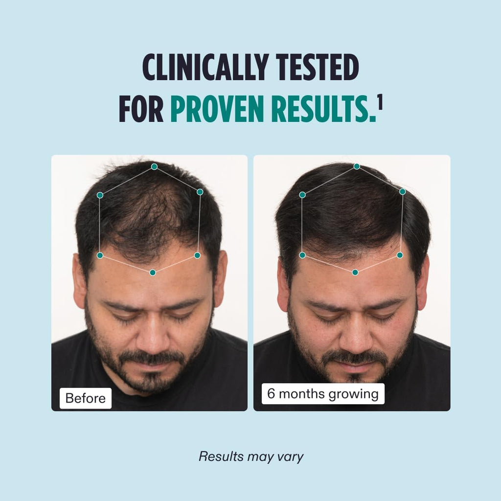Nutrafol Men's Hair Growth Supplement 3-Month Supply