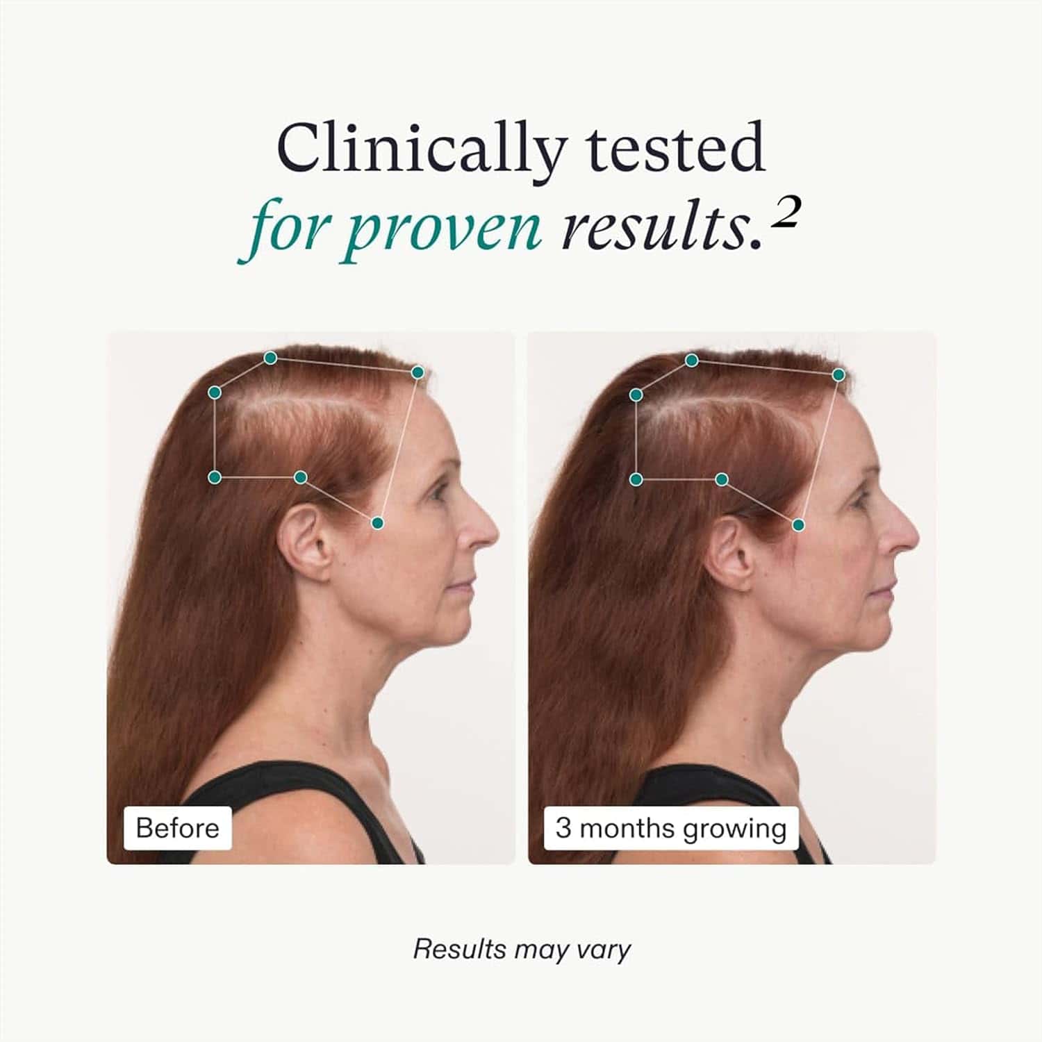 Nutrafol Women's Balance Hair Growth Pack 3-Month Supply