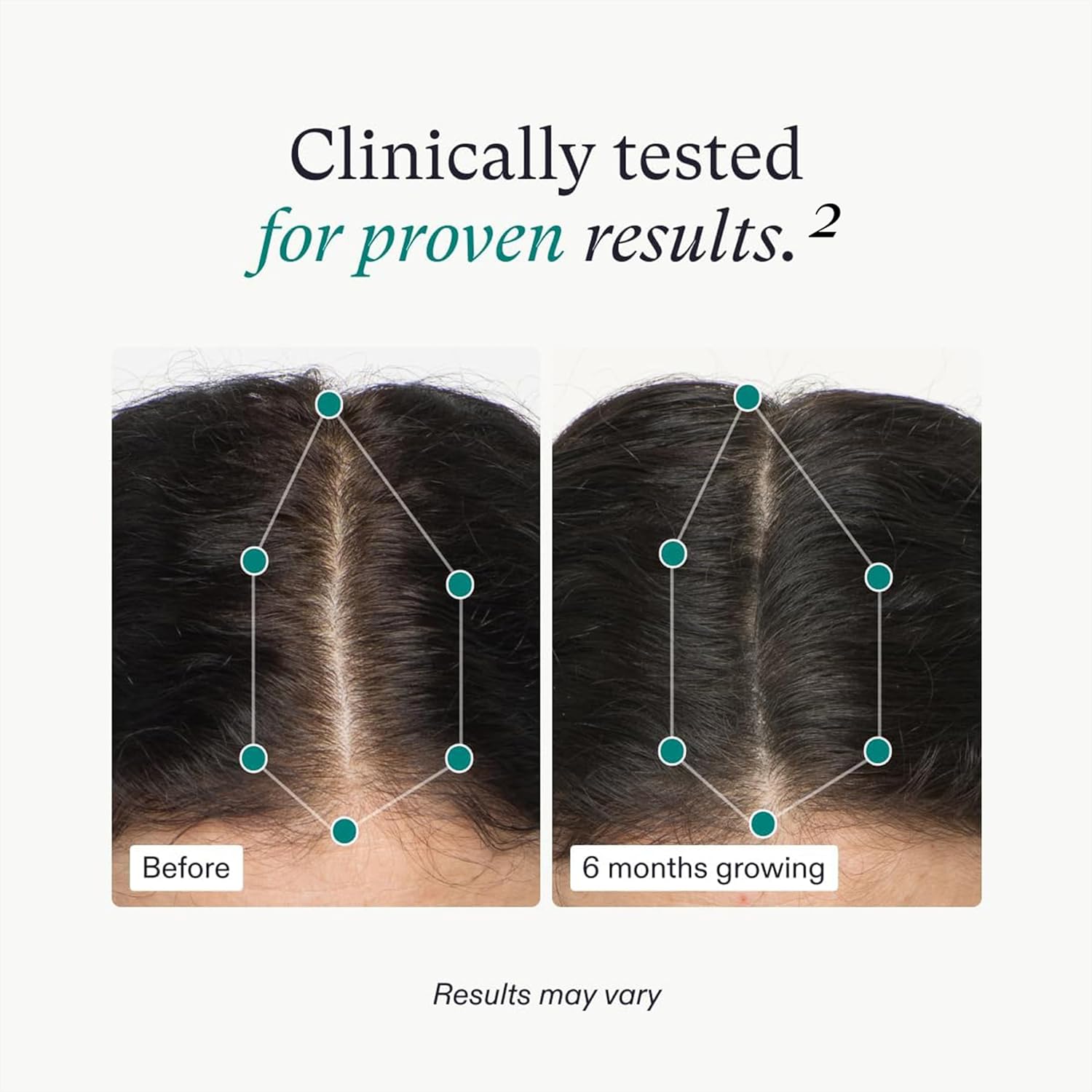 Nutrafol Women's Hair Growth for Thicker, Stronger Hair 3-Month Supply