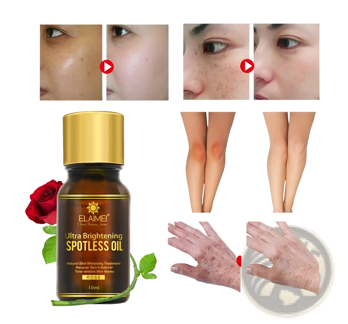 Ultra Brightening Spotless Oil 10ml for Dark Spots
